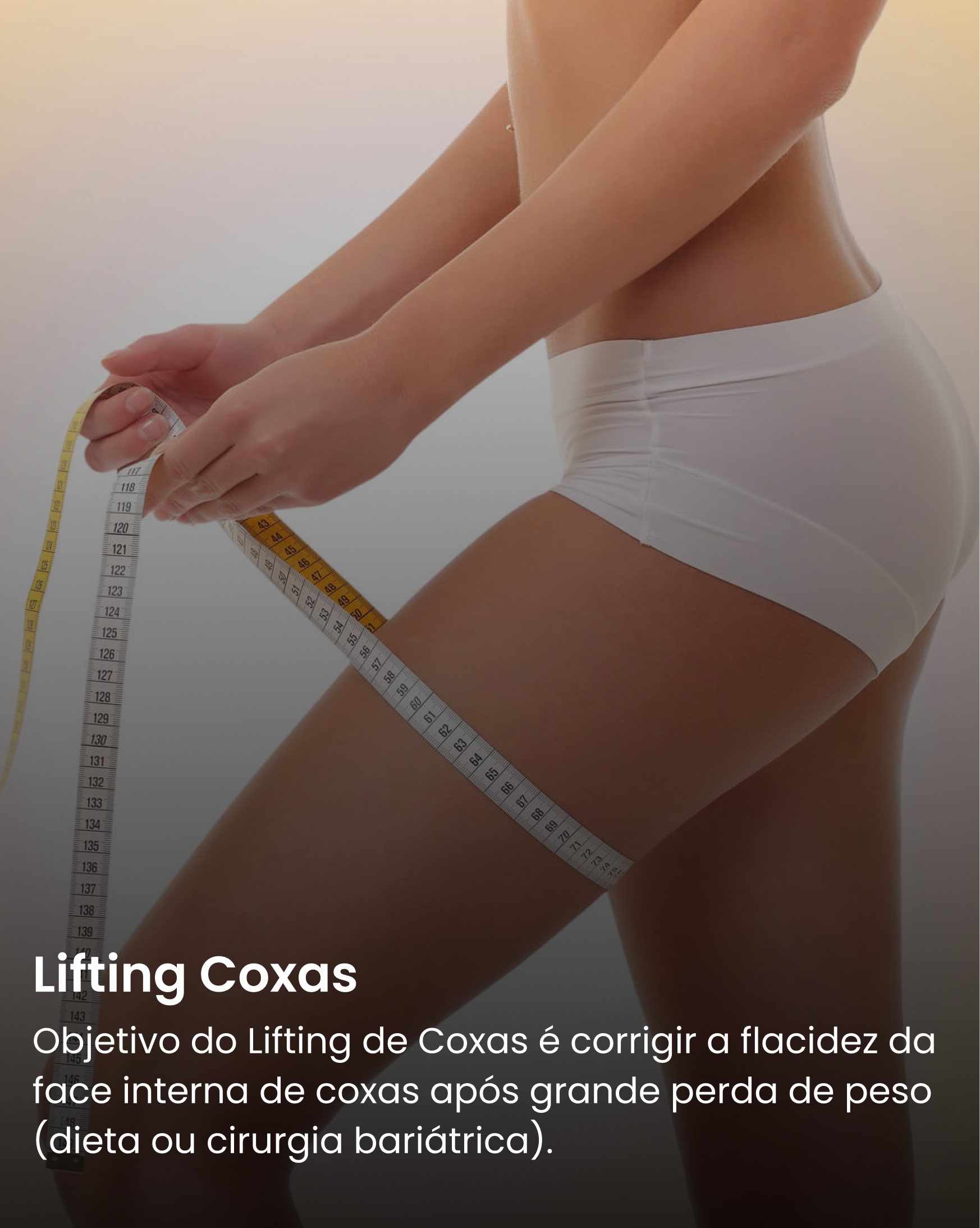 Lifting Coxas