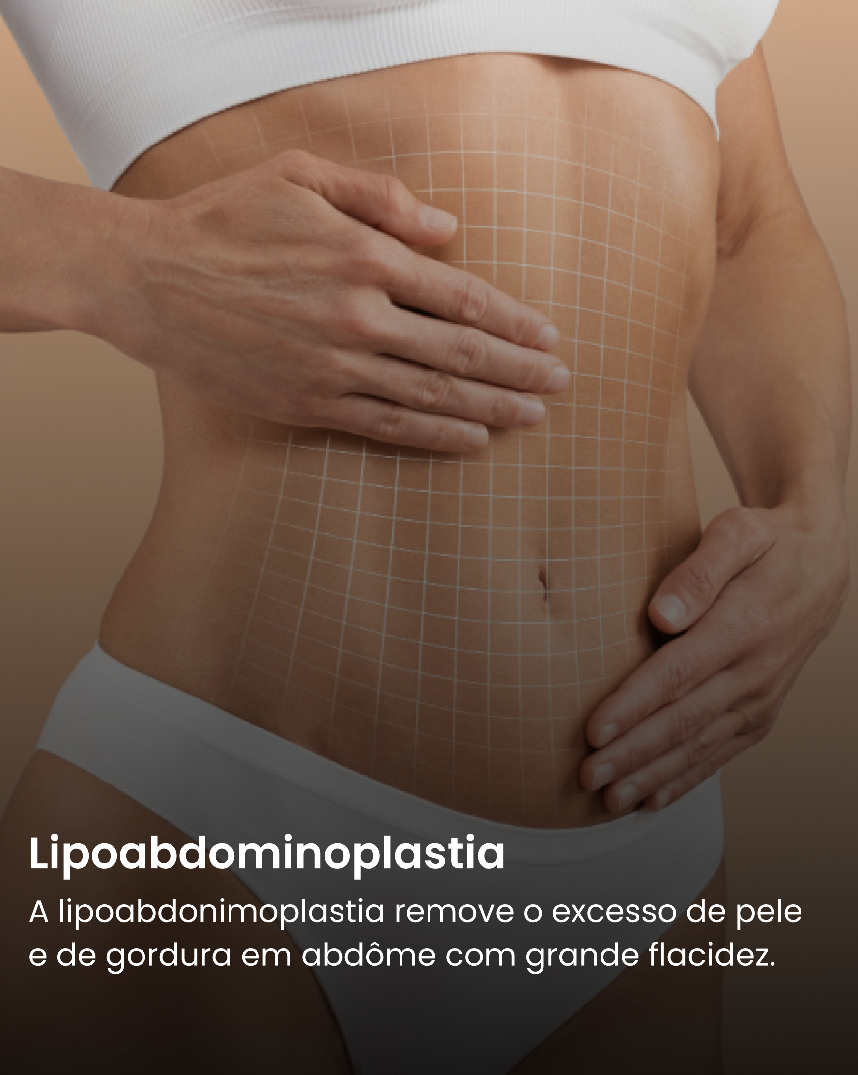 Lipoabdominoplastia