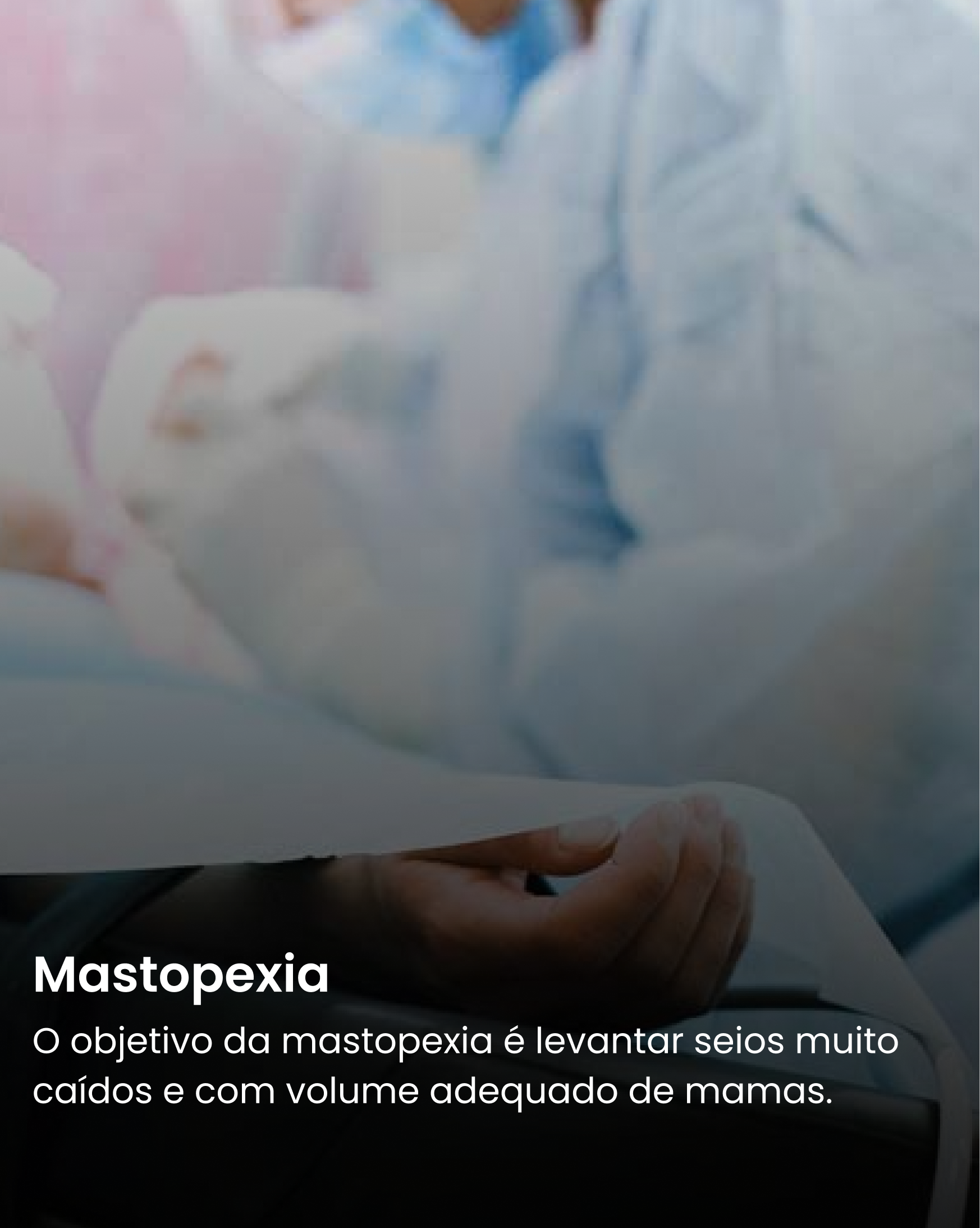Mastopexia
